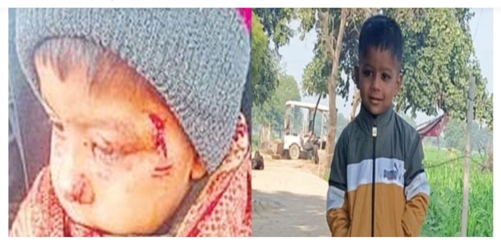 आगरा में दिल दहला देने वाली घटना: कुत्ते के काटने से 6 साल के मासूम की मौत, रेबीज ने ली नर्सरी के छात्र की जान