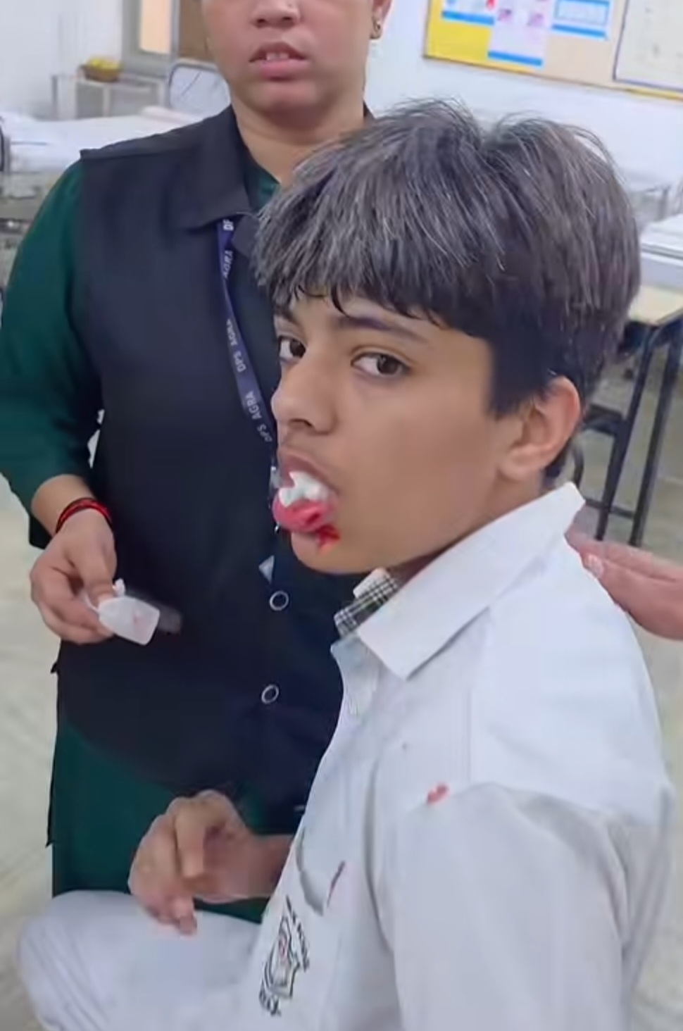 आगरा के DPS स्कूल में 10वीं के छात्र की बेरहमी से पिटाई, कई दांत टूटे; यूट्यूबर पीयूष मल्होत्रा के बेटे की हालत गंभीर